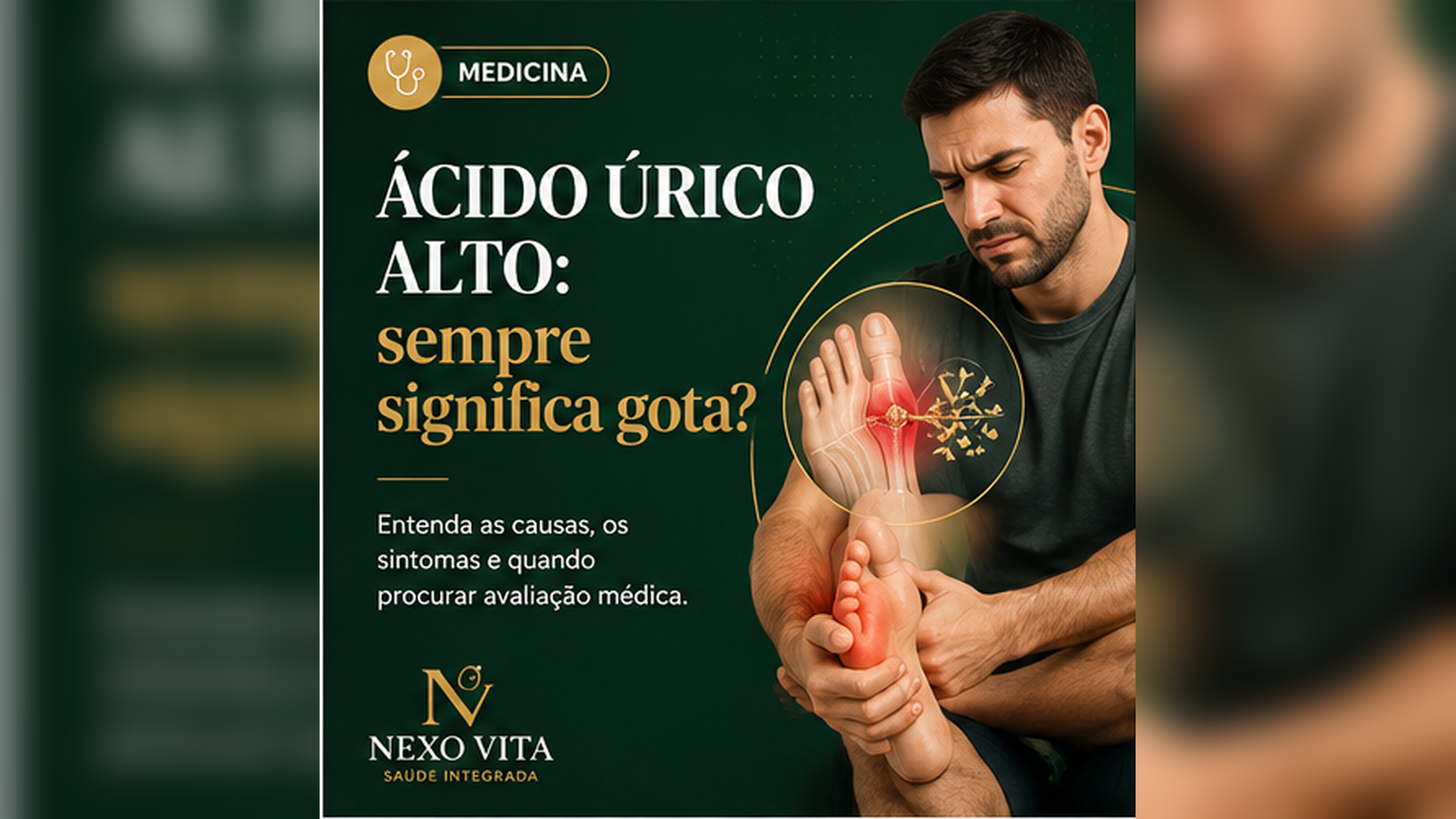Ilustração educativa sobre ácido úrico elevado e articulação dolorosa do pé