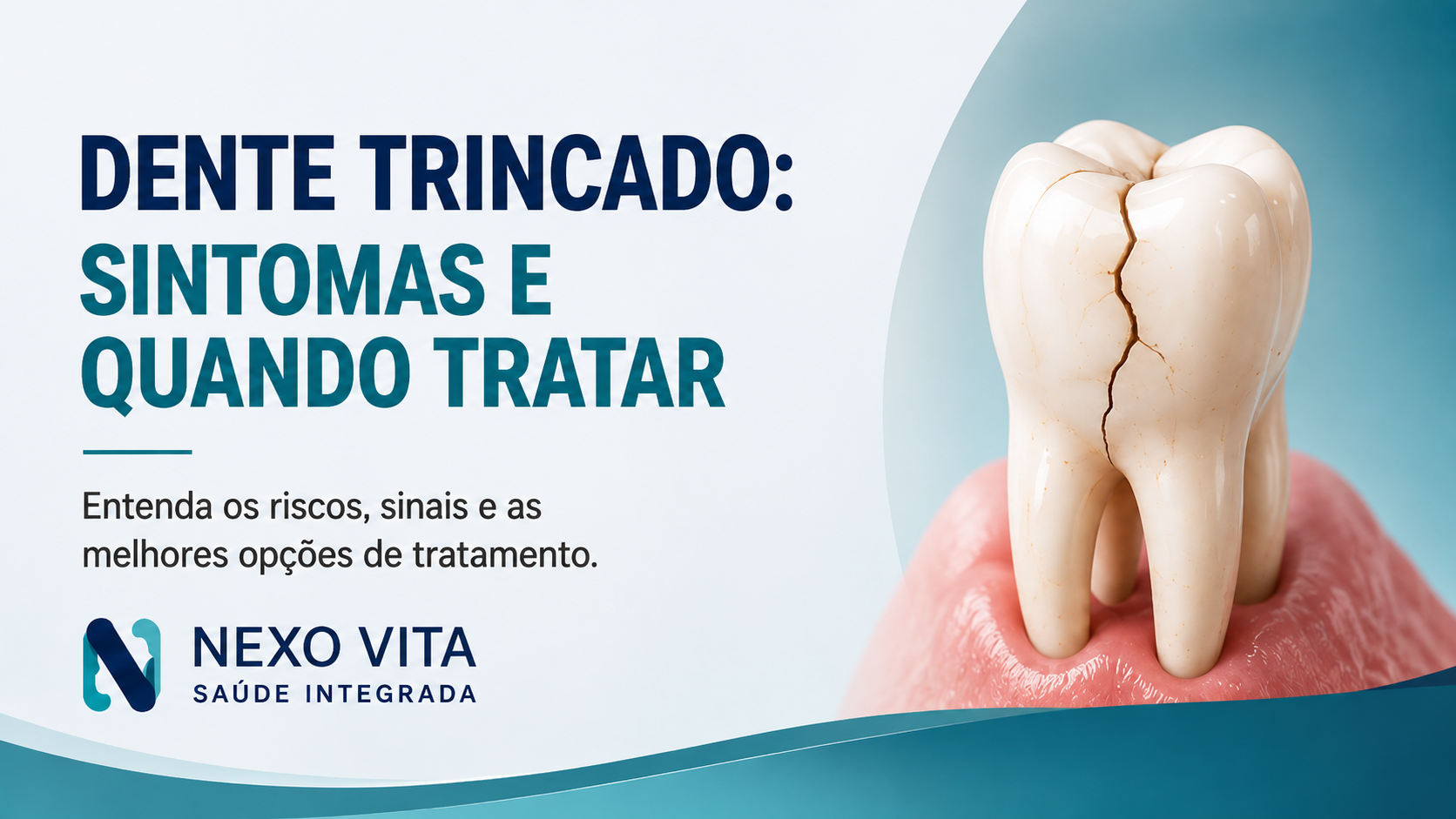 Ilustração odontológica de um dente com linha de trinca