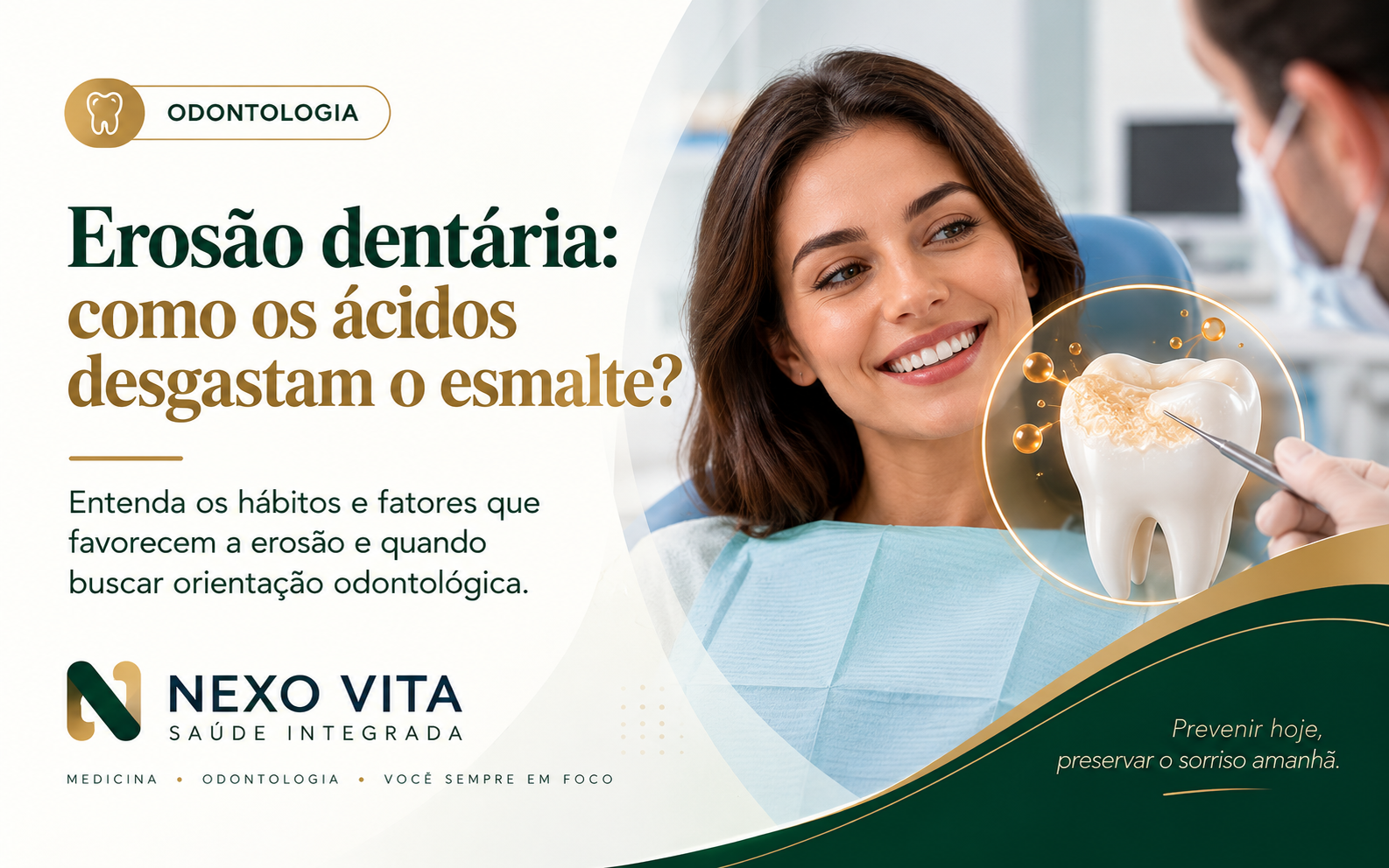 Modelo odontológico demonstrando desgaste progressivo do esmalte por ação ácida