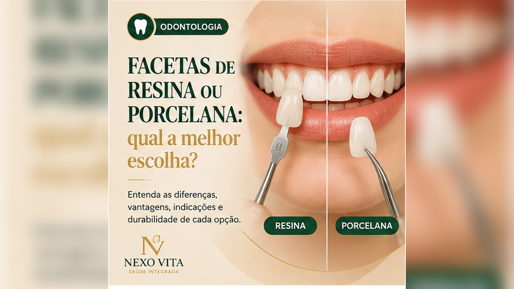 Sorriso em avaliação estética odontológica para planejamento de facetas dentárias