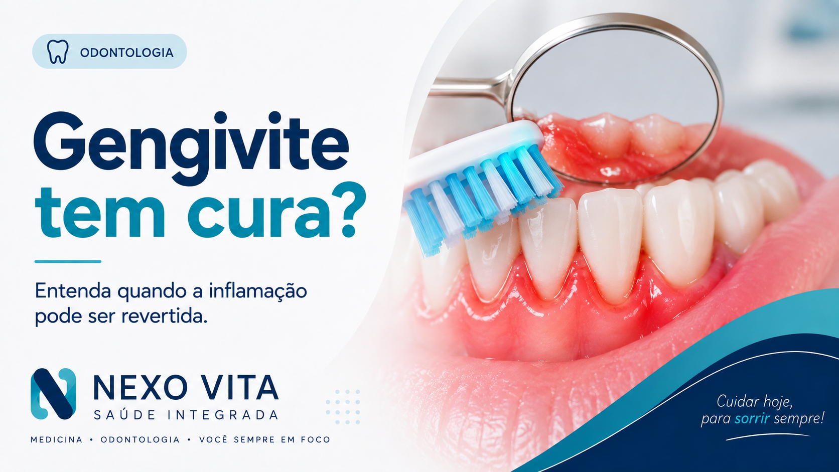 Gengiva saudável comparada a gengiva avermelhada e inflamada