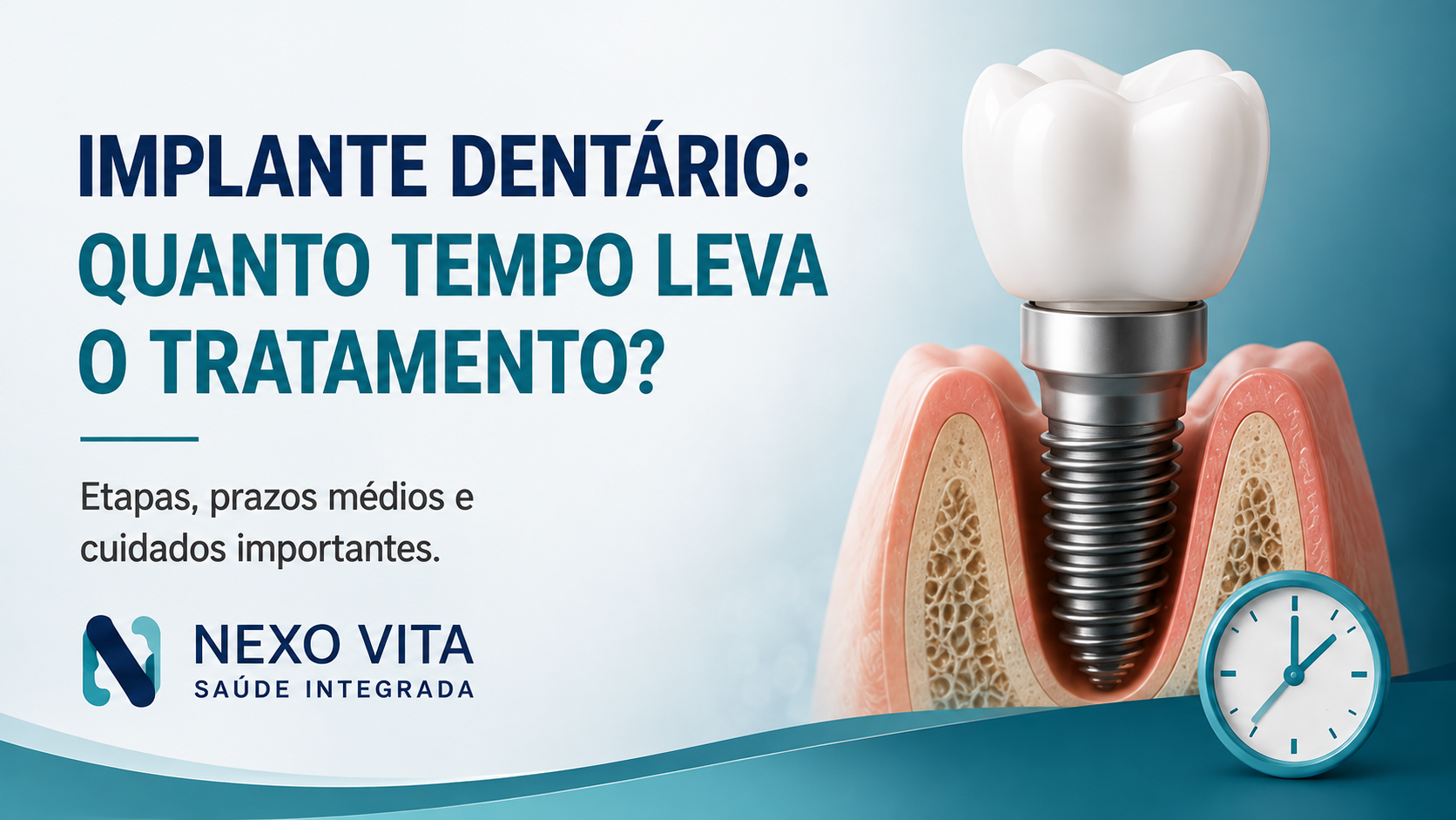 Planejamento odontológico de implante dentário em modelo de arcada
