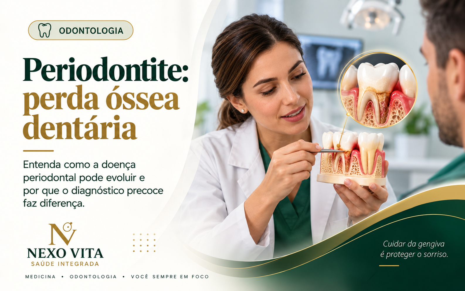 Representação odontológica de gengiva inflamada e perda óssea ao redor dos dentes