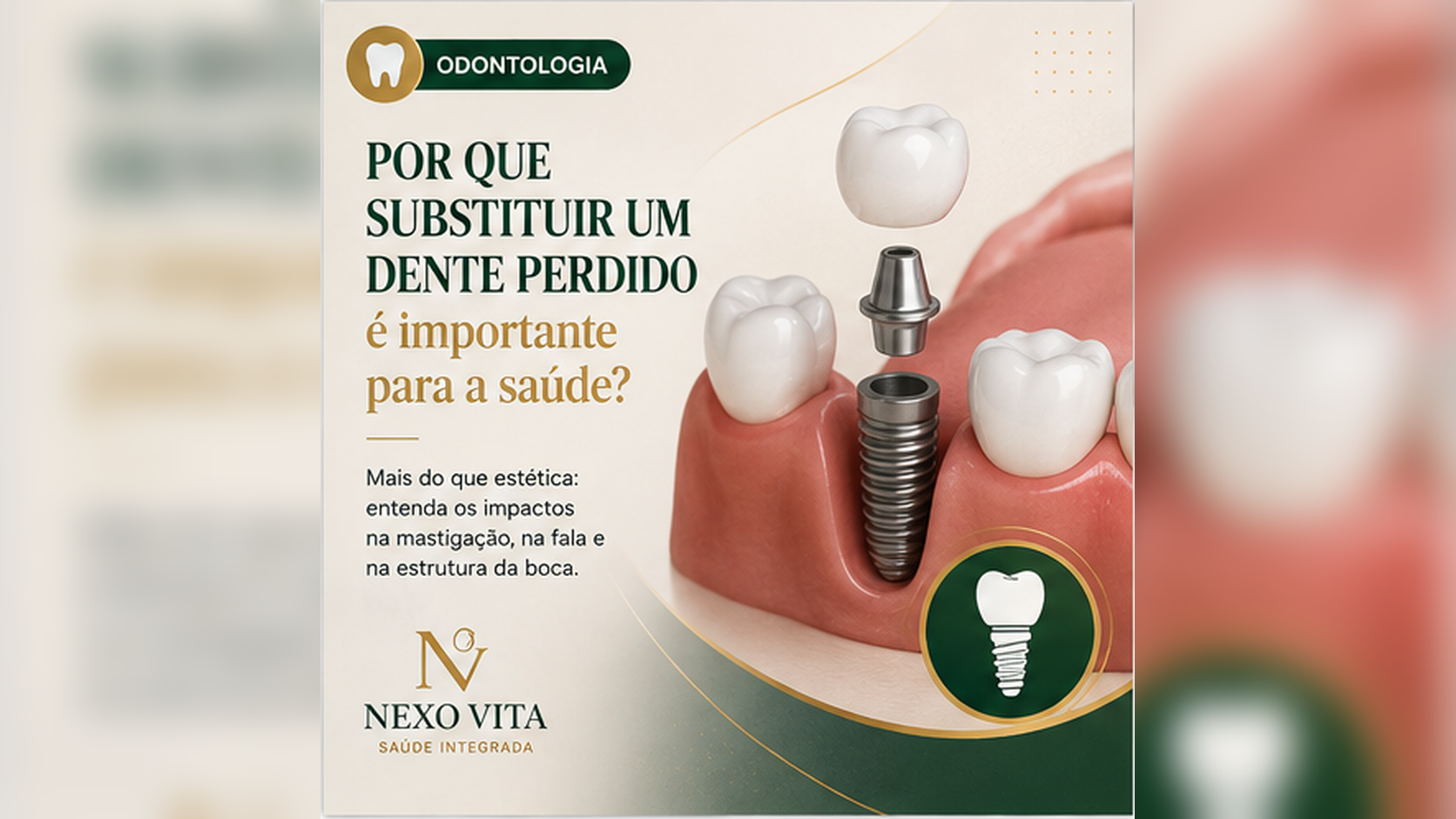 Arcada dentária com espaço correspondente a um dente perdido